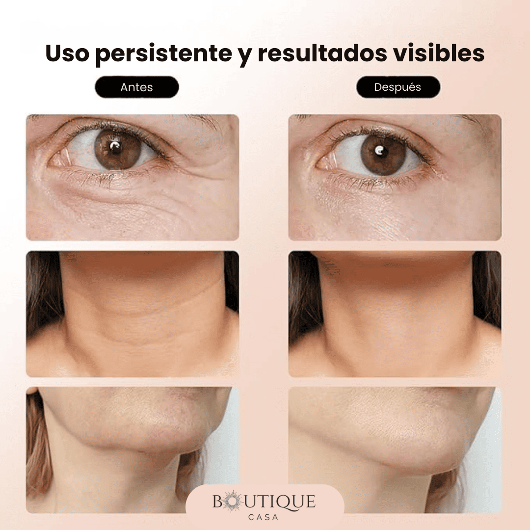 Masajeador Facial Eléctrico 3 en 1 | FaceLift™