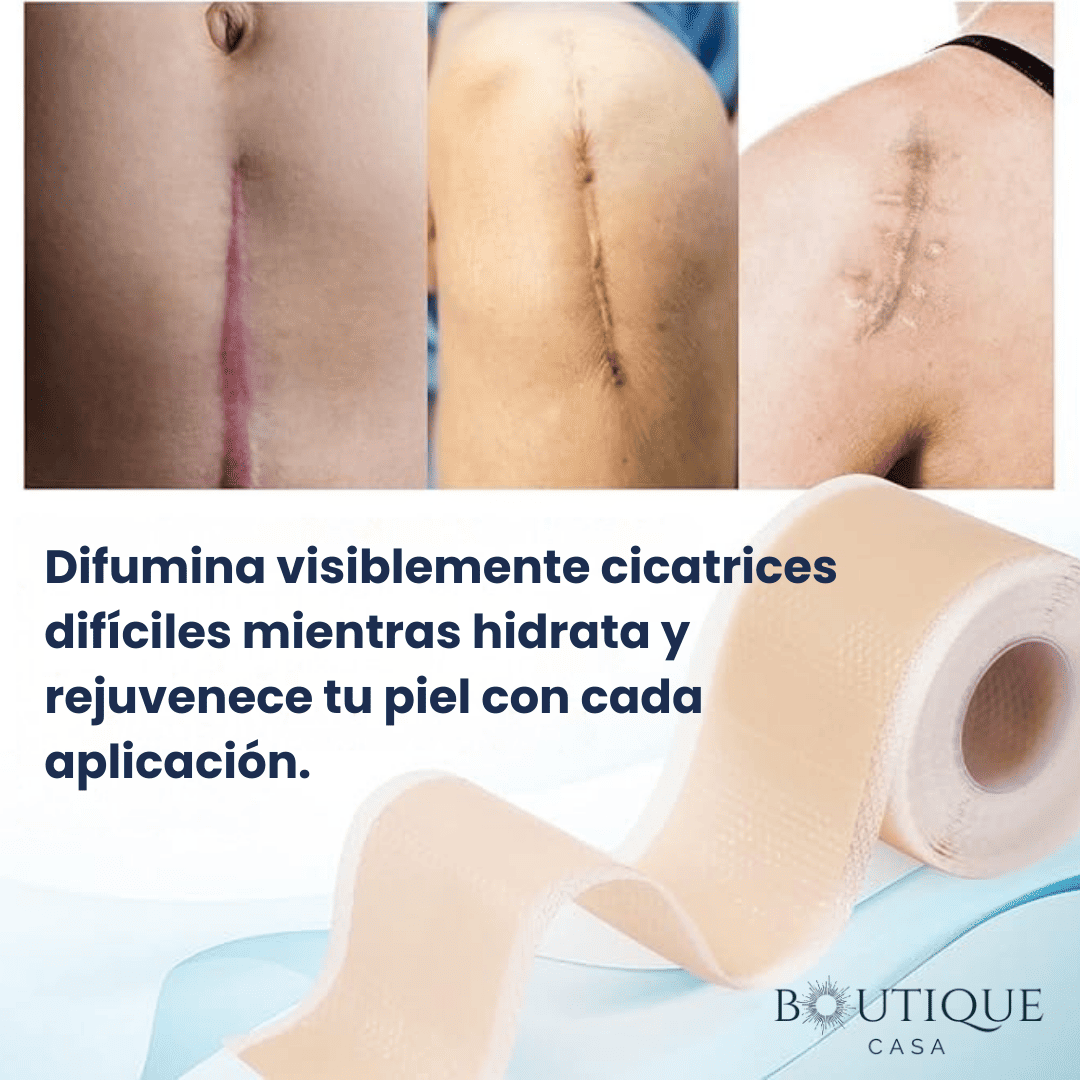 Rollo de Silicona para Cicatrices | CicaClear™