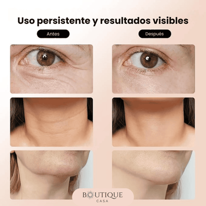 Masajeador Facial Eléctrico 3 en 1 | FaceLift™