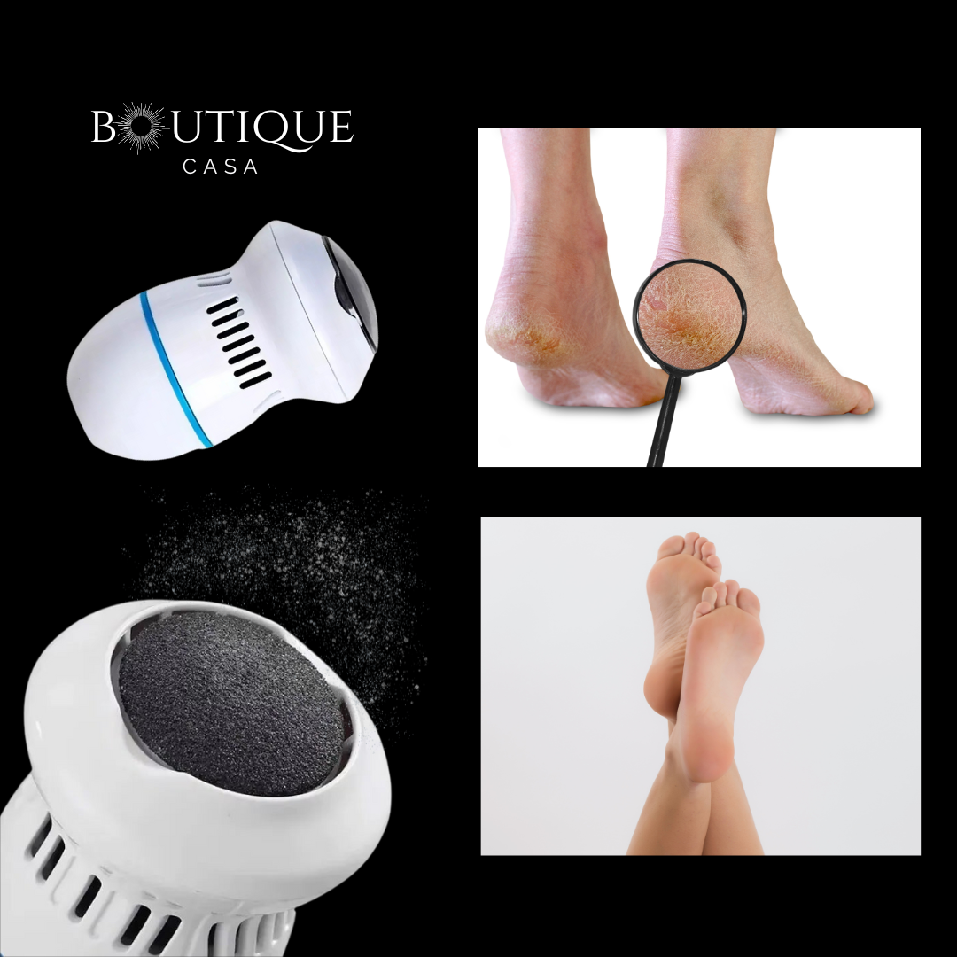 Dermapies Pro - Eliminador de Callos – Tratamiento de durezas y mejora de tu bienestar