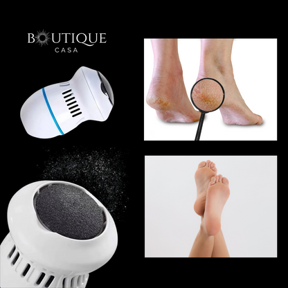 Dermapies Pro - Eliminador de Callos – Tratamiento de durezas y mejora de tu bienestar